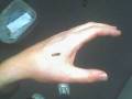 RFID human implant
